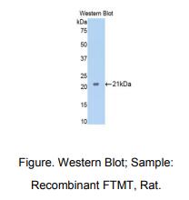 https://msimg.bioon.com/bionline/goods-no-pic.png