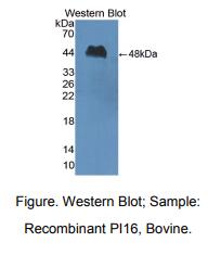 https://msimg.bioon.com/bionline/goods-no-pic.png