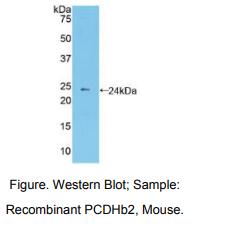 小鼠原钙黏素β2(PCDHb2)多克隆抗体