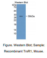 https://msimg.bioon.com/bionline/goods-no-pic.png