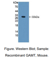 https://msimg.bioon.com/bionline/goods-no-pic.png