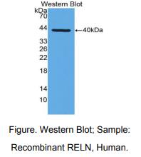 https://msimg.bioon.com/bionline/goods-no-pic.png