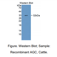 https://msimg.bioon.com/bionline/goods-no-pic.png