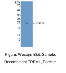 https://msimg.bioon.com/bionline/goods-no-pic.png