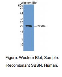 人上池蛋白(SBSN)多克隆抗体