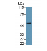 https://msimg.bioon.com/bionline/goods-no-pic.png