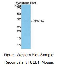 小鼠微管蛋白β1(TUBb1)多克隆抗体