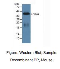 https://msimg.bioon.com/bionline/goods-no-pic.png