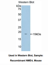 https://msimg.bioon.com/bionline/goods-no-pic.png