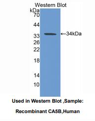 https://msimg.bioon.com/bionline/goods-no-pic.png