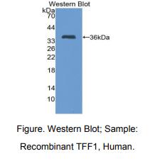 https://msimg.bioon.com/bionline/goods-no-pic.png