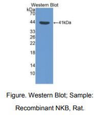 大鼠神经激肽B(NKB)多克隆抗体