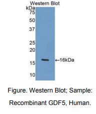 人生长分化因子5(GDF5)多克隆抗体