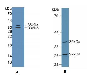 人线粒体肿瘤抑制因子1(MTUS1)多克隆抗体