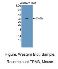 小鼠原肌球蛋白3(TPM3)多克隆抗体
