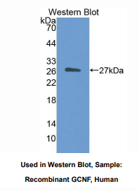 https://msimg.bioon.com/bionline/goods-no-pic.png