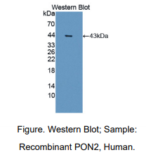 https://msimg.bioon.com/bionline/goods-no-pic.png