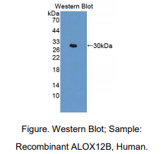 人花生四烯酸-12-脂加氧酶12R(ALOX12B)多克隆抗体