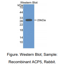 https://msimg.bioon.com/bionline/goods-no-pic.png