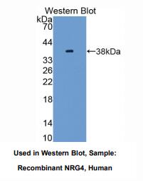 https://msimg.bioon.com/bionline/goods-no-pic.png