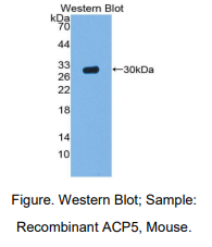 https://msimg.bioon.com/bionline/goods-no-pic.png