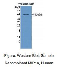 https://msimg.bioon.com/bionline/goods-no-pic.png