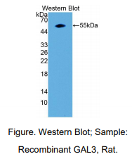 https://msimg.bioon.com/bionline/goods-no-pic.png