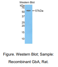 大鼠葡萄糖脑苷脂酶(GBA)多克隆抗体