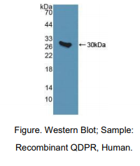 人醌型二氢蝶啶还原酶(QDPR)多克隆抗体
