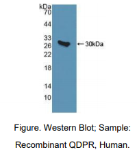 https://msimg.bioon.com/bionline/goods-no-pic.png