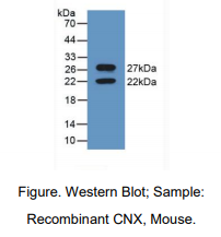 https://msimg.bioon.com/bionline/goods-no-pic.png