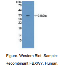 https://msimg.bioon.com/bionline/goods-no-pic.png