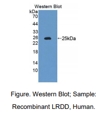 https://msimg.bioon.com/bionline/goods-no-pic.png