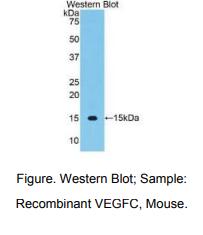 https://msimg.bioon.com/bionline/goods-no-pic.png