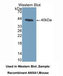 https://msimg.bioon.com/bionline/goods-no-pic.png