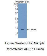 https://msimg.bioon.com/bionline/goods-no-pic.png