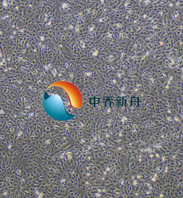 人肝胆管癌细胞