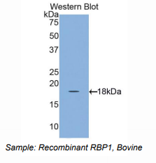 牛视黄醇结合蛋白1(RBP1)多克隆抗体