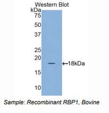 https://msimg.bioon.com/bionline/goods-no-pic.png