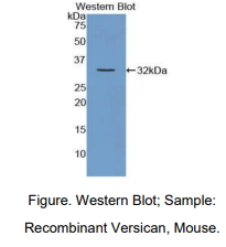 https://msimg.bioon.com/bionline/goods-no-pic.png