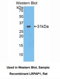 https://msimg.bioon.com/bionline/goods-no-pic.png