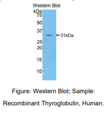 人甲状腺球蛋白(TG)多克隆抗体