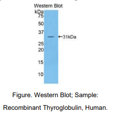 https://msimg.bioon.com/bionline/goods-no-pic.png