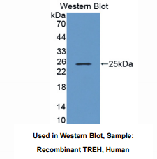 https://msimg.bioon.com/bionline/goods-no-pic.png