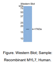 人肌球蛋白轻链7(MYL7)多克隆抗体