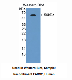 https://msimg.bioon.com/bionline/goods-no-pic.png