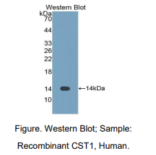 https://msimg.bioon.com/bionline/goods-no-pic.png