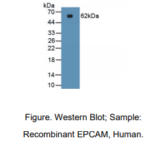 https://msimg.bioon.com/bionline/goods-no-pic.png