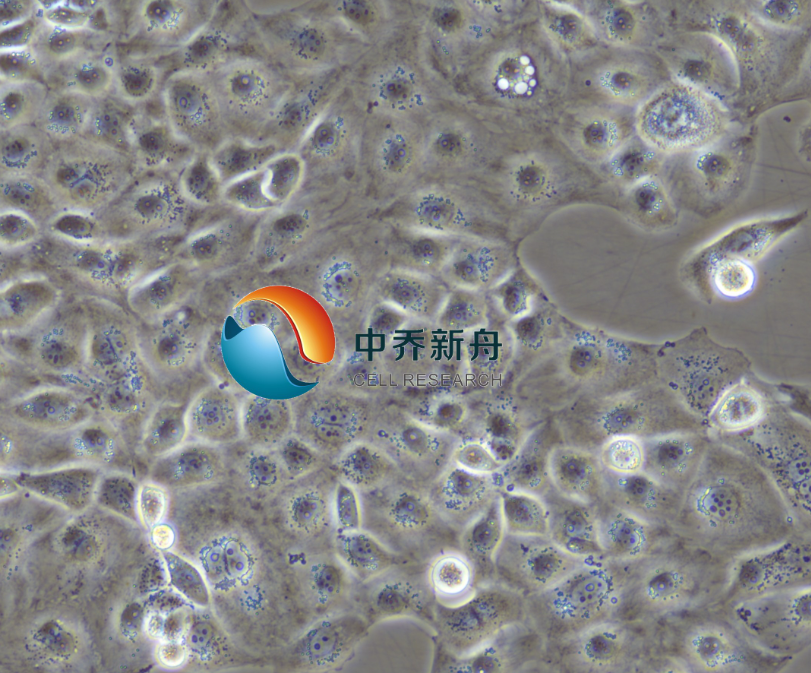 人卵巢癌细胞