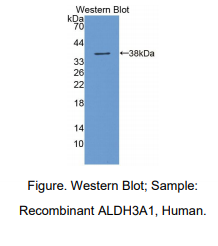 人醛脱氢酶3家族成员A1(ALDH3A1)多克隆抗体